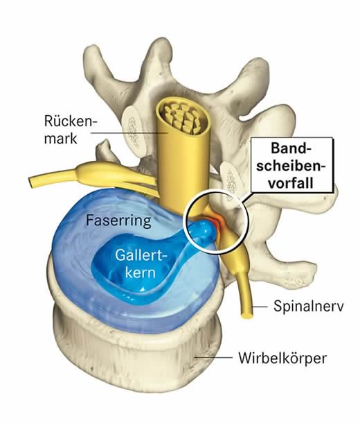 Anatomie Wirbelkörper